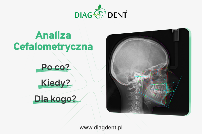 Analiza cefalometryczna - kiedy warto wykonać?