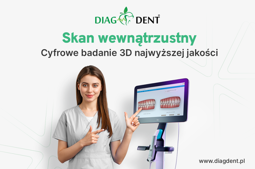 Skanowanie wewnątrzustne - co warto wiedzieć?