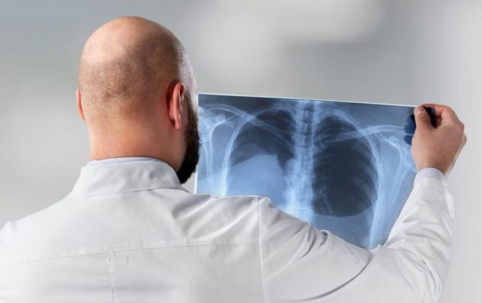 Promieniowanie rentgenowskie – kiedy i jak zostało odkryte?