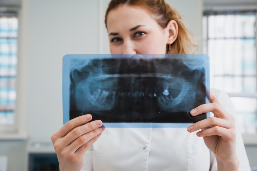 O promieniowaniu rentgenowskim w stomatologii
