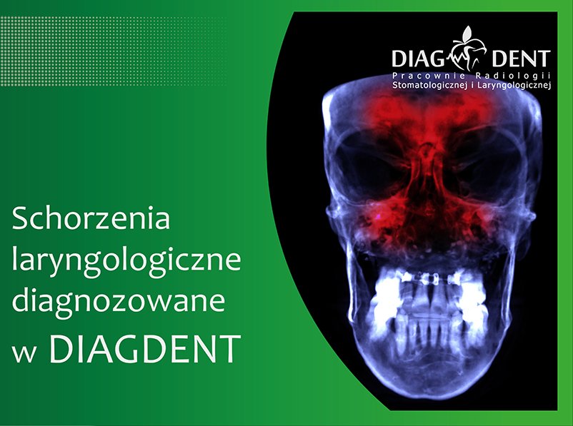 Schorzenia laryngologiczne diagnozowane w DIAGDENT