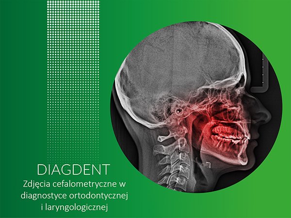 Zdjęcia cefalometryczne w diagnostyce ortodontycznej i laryngologicznej