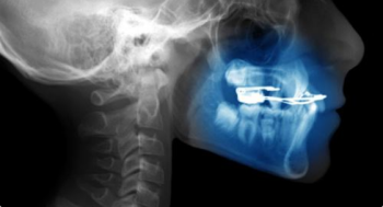 Cephalometry